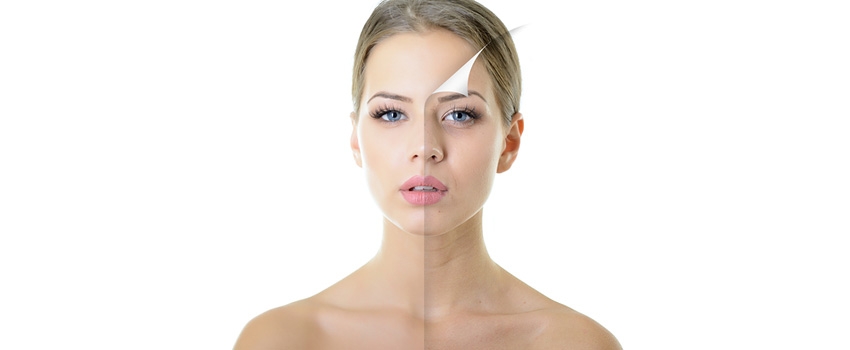 LASER SKIN TIGHTENING